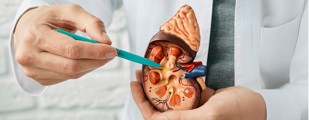 Cáncer renal: comprendiendo la enfermedad, prevención y tratamiento