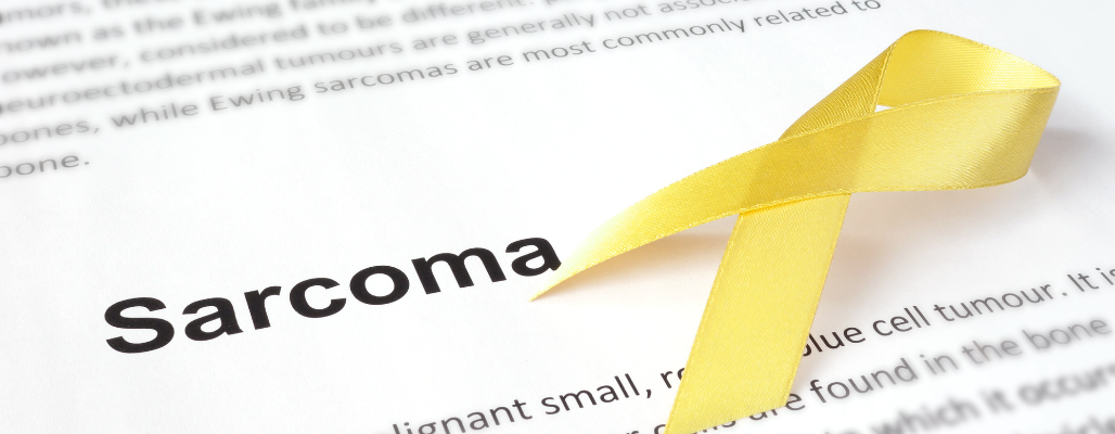 Sarcoma: comprendiendo el cáncer que nace del tejido profundo