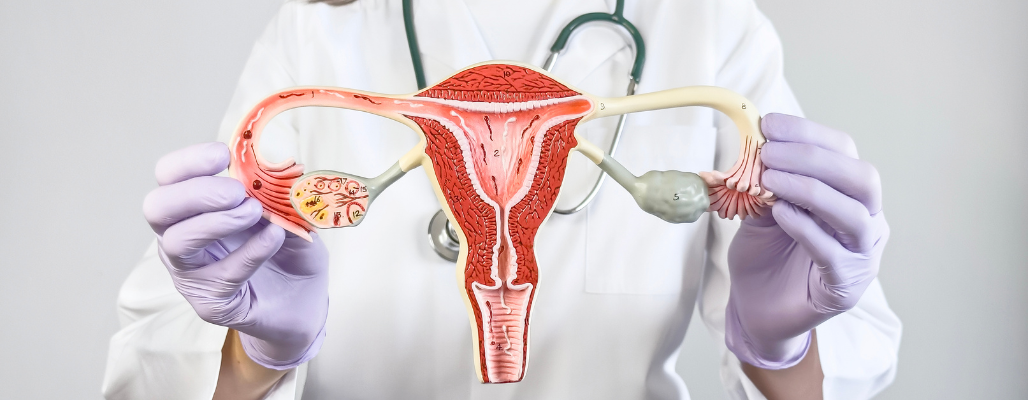Salud Hormonal Femenina: Cómo la Medicina Funcional Transforma el Manejo del Síndrome de Ovario Poliquístico (SOP)