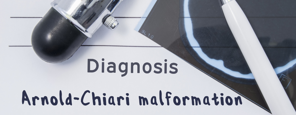 Síndrome de Arnold-Chiari: Enfoque funcional para un trastorno neurológico complejo