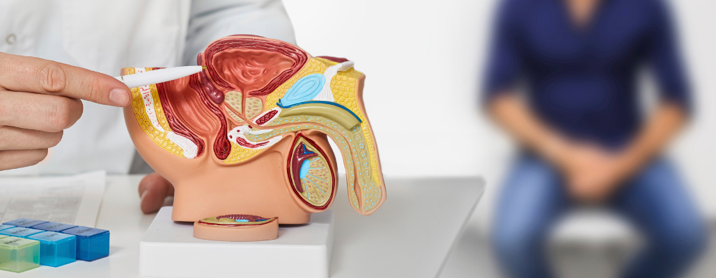 Salud de la próstata: Enfoque funcional para su prevención y cuidado integral