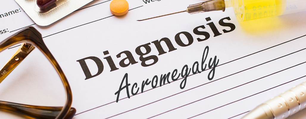 Acromegalia: Comprendiendo y apoyando la salud hormonal