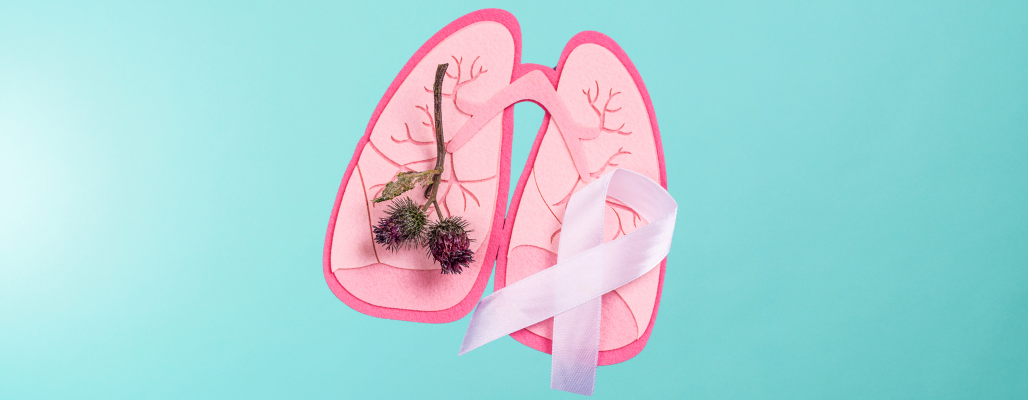 Cáncer de pulmón: Comprendiendo y apoyando la salud respiratoria