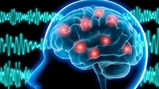 Epilepsia desde un enfoque funcional e integrativo