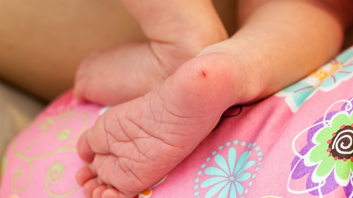 Fenilcetonuria (PKU) desde un enfoque funcional