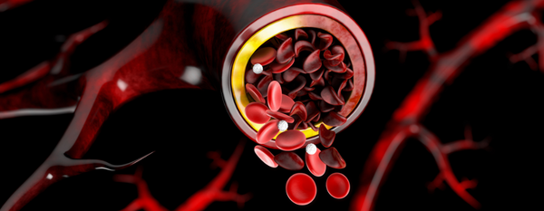 Un enfoque de medicina integral para el tratamiento de la anemia falciforme