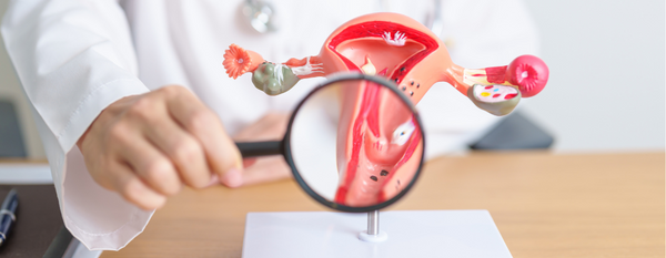 Cáncer de ovario: comprendiendo la enfermedad y el tratamiento funcional