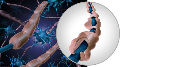 Esclerosis lateral amiotrófica (ELA): Comprendiendo una enfermedad desafiante