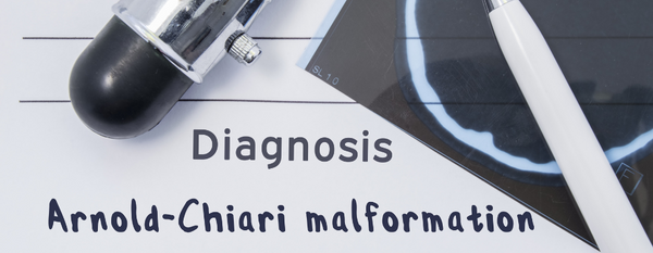 Síndrome de Arnold-Chiari: Enfoque funcional para un trastorno neurológico complejo