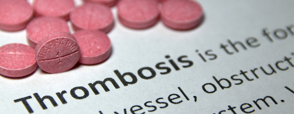Trombosis: Comprendiendo la formación de coágulos y su prevención