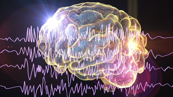 Epilepsia desde la medicina funcional: Comprender las causas raíz y nuevas estrategias de apoyo neurológico